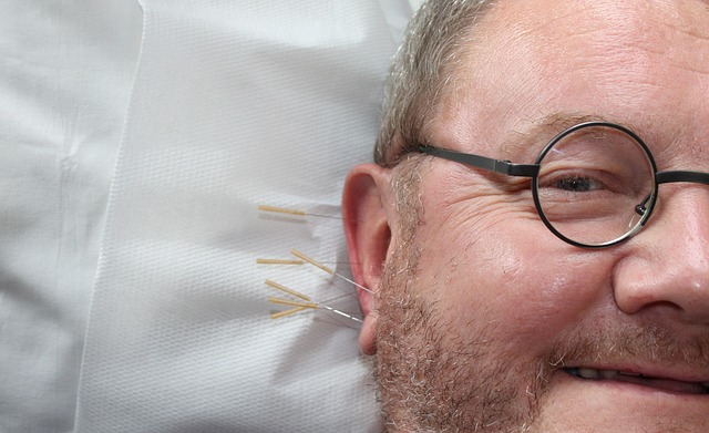 Therapeutic needles Therapeutic needles